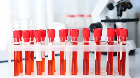 Twenty test tubes filled with red fluid in laboratory